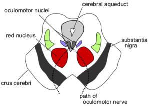 Поперечный разрез среднего мозга с указанием местоположения красного ядра. В верхней части изображения находятся четверохолмие и ножка среднего мозга, отчётливо видны водопровод среднего мозга, чёрная субстанция и ядро глазодвигательного нерва.