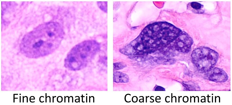 File:Fine versus coarse chromatin.jpg