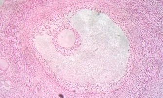 Histological view of an ovarian follicle. The egg is located within the smaller ring. Ovarian follicle.png