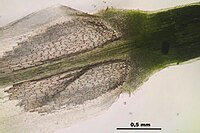 Vue au microscope de la gaine embrassante à la base de la feuille de Polytrichum commune.