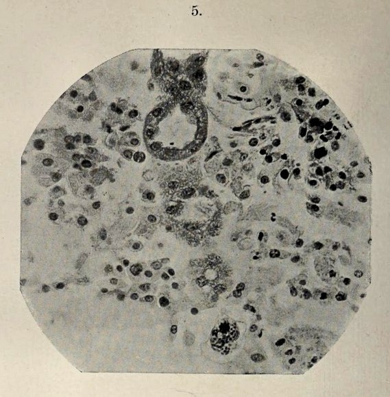 Bestand:Trichosomoides crassicauda (06).tif