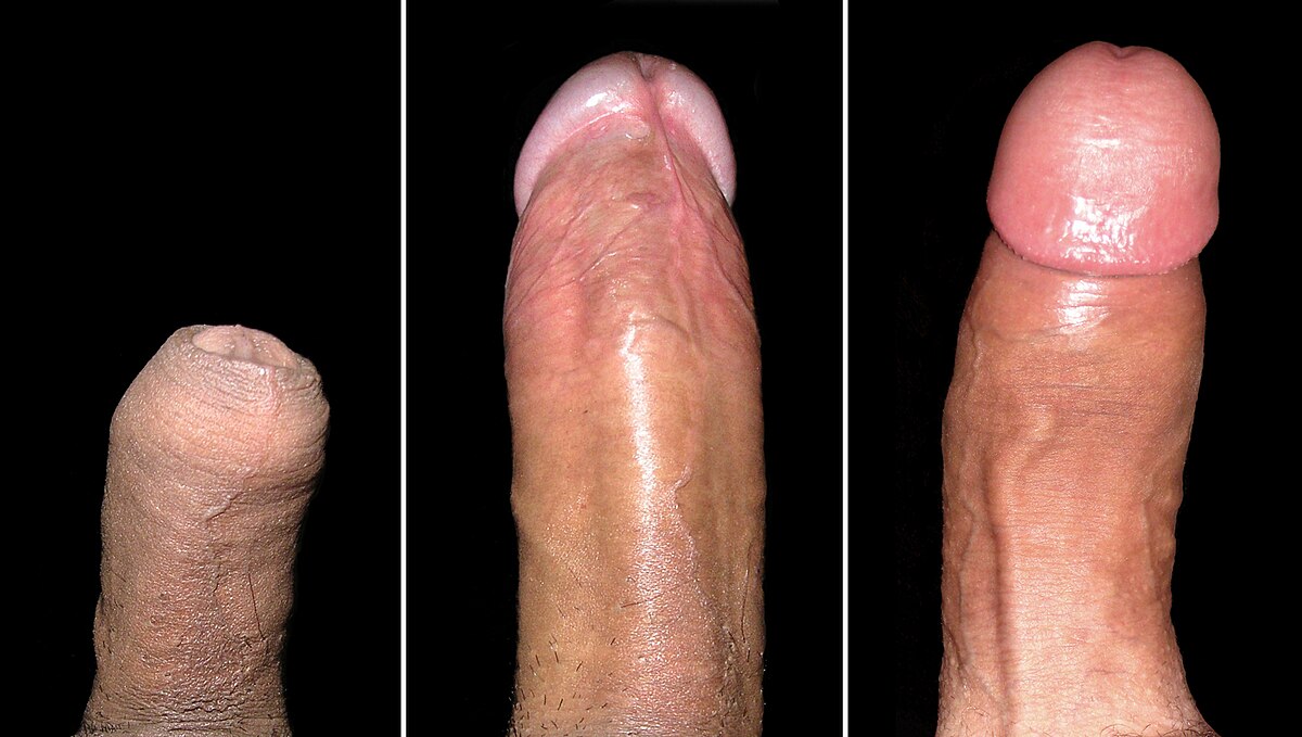 File:Ventral and Dorsal View of Penis.jpg - Wikipedia