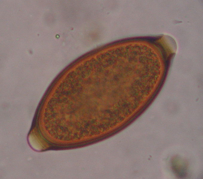 File:Whipworm egg crop.JPG