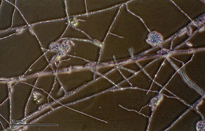 Opis zdjęcia Fusarium solani (257 25) Hodowlane i barwione deuteromycetes.jpg.