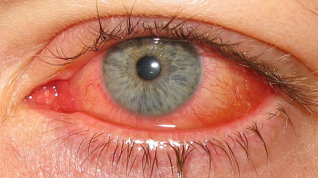 Eye examination - Wikipedia