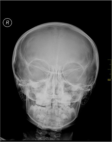 File:Medical X-Ray imaging LJM05 nevit.jpg