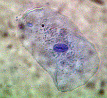 Staining in vivo with methylene blue of a cell from the mucous membrane of a human mouth Mundschleimhautzelle.jpg