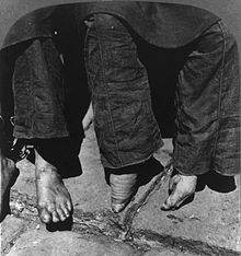 Foot binding - Wikipedia