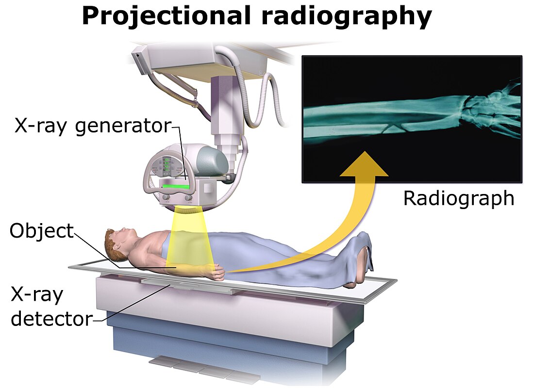 X-ray detector