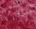 Queratinocitos del estrato espinoso de piel gruesa de mamífero.jpg