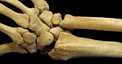 Aspek-aspek posterior dan anterior pergelangan tangan kanan manusia