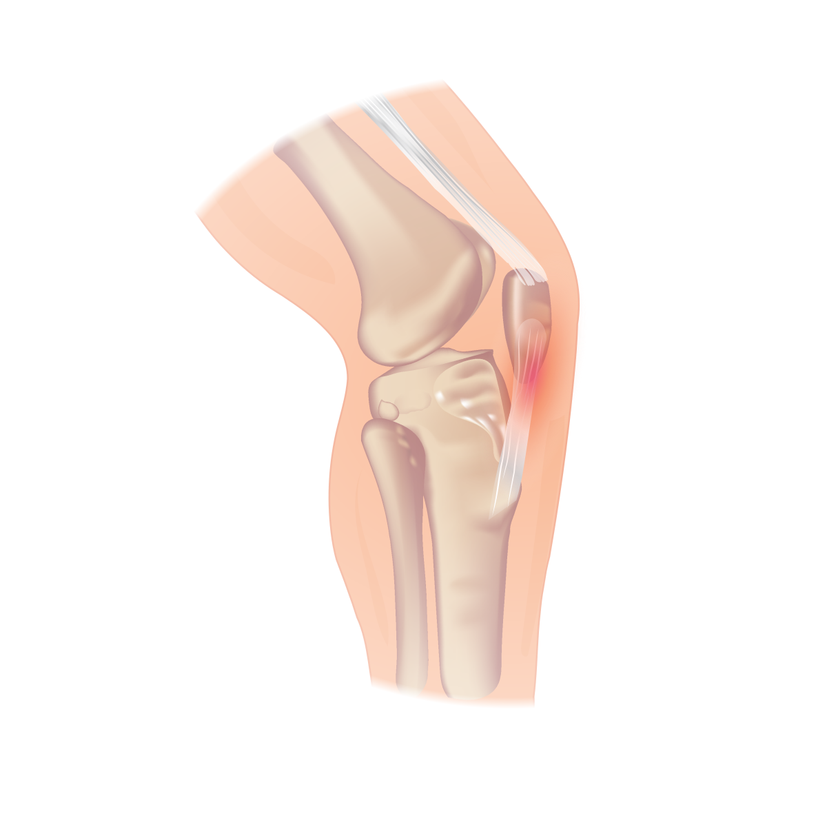 Soft tissue - Wikipedia