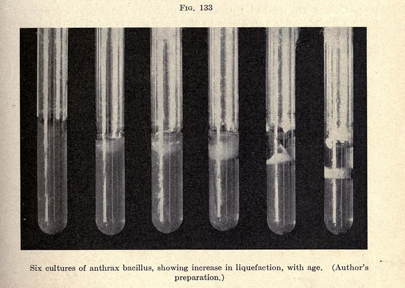 File:Anthrax Bacillus Cultures - A Text-Book on Disease-Producing Microörganisms - By Maximilian Herzog, 1910.jpg
