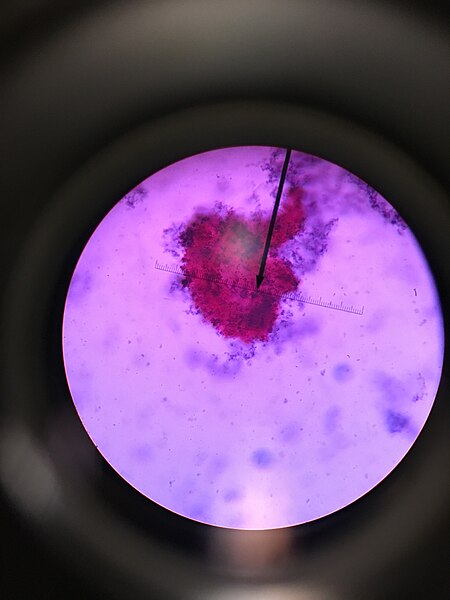 File:Blood shown through a telescope at a microscopic level.jpg