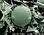 CSIRO ScienceImage 1392 Scanning Electron Micrograph of Chytrid Fungus.jpg