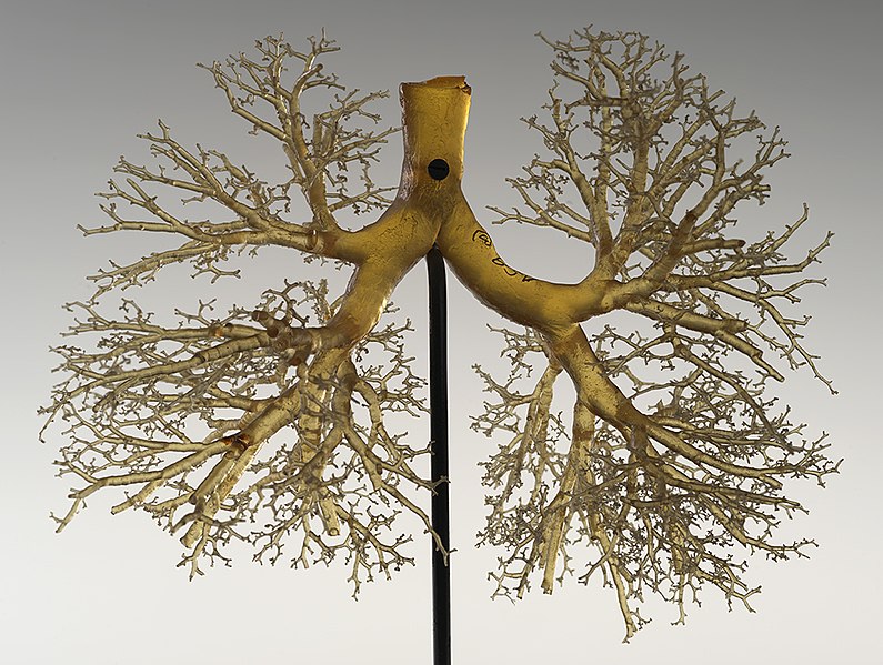 File:Casts of lungs, Marco resin, 1951 (23966574469).jpg