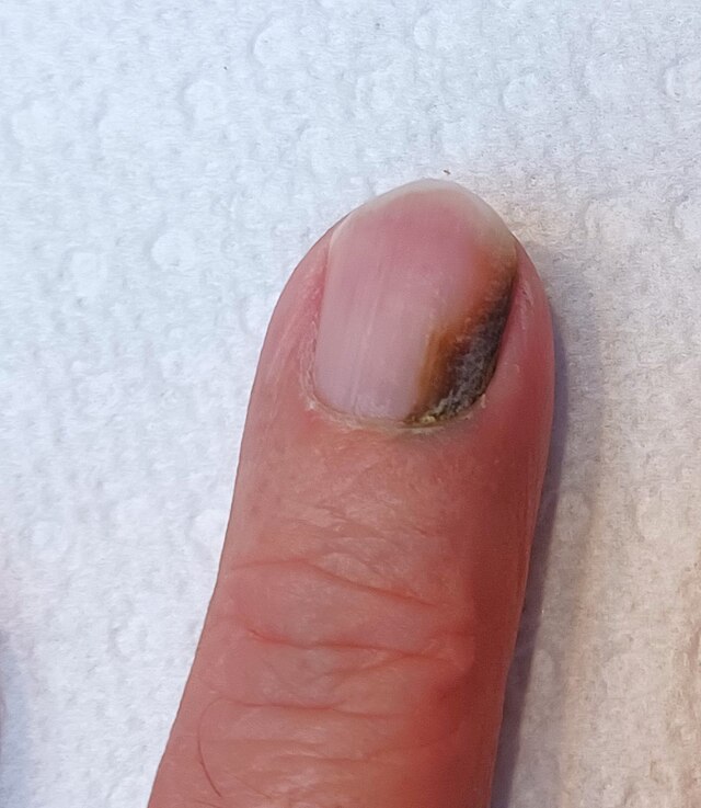 Solved] Contraindications and skin/nail conditions Complete all areas of...  | Course Hero