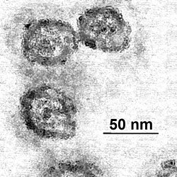 Em flavavirus-HCV samp1c.jpg