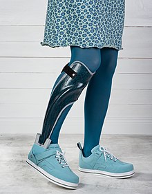 Ankle-foot orthosis with dynamic functional elements, whose adjustable spring resistances in plantar and dorsiflexion can be separately adapted to the patient's gait. The orthosis is used to improve safety when standing and walking. (Designation of the orthosis according to the body parts included in the orthosis fitting: ankle and foot, English abbreviation: AFO for ankle-foot orthoses) FG 76.jpg