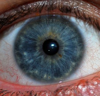 Human Iris, Blue Type
