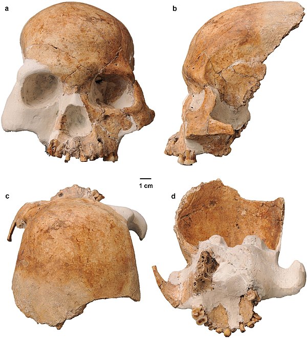 LL-1 partials skull