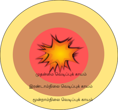 File:Mechanism of Blast Injuries-ta.svg