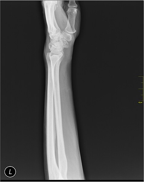 File:Medical X-Ray imaging QVJ06 nevit.jpg