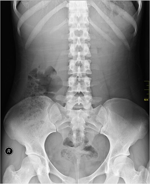File:Medical X-Ray imaging VCM07 nevit.jpg