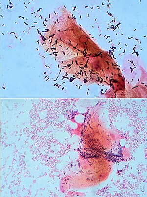 Normal- und BV-flora.jpg