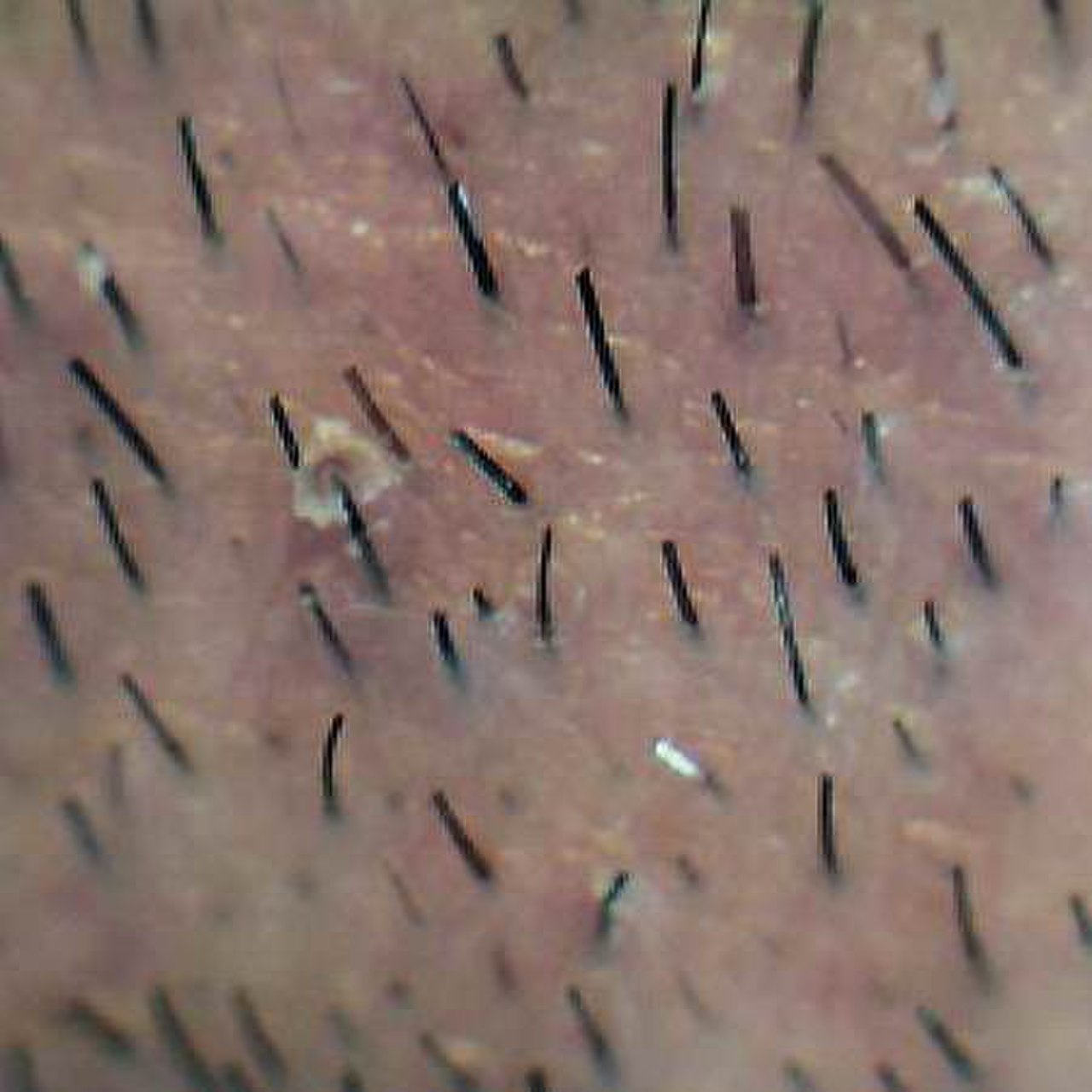 Волосы после бритья под микроскопом