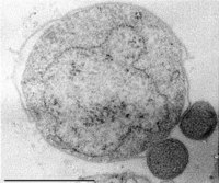 Nanoarchaeum equitans and archaeon host, Ignicoccus