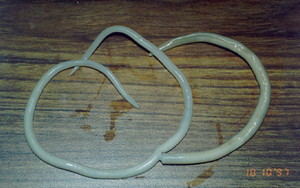 Ascaris lumbricoides adult worms.png