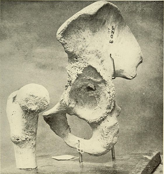 File:Bulletin of the Warren Anatomical Museum (1910) (14763149315).jpg