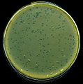 Placche di lisi di una coltura di E. coli da parte del batteriofago lambda.