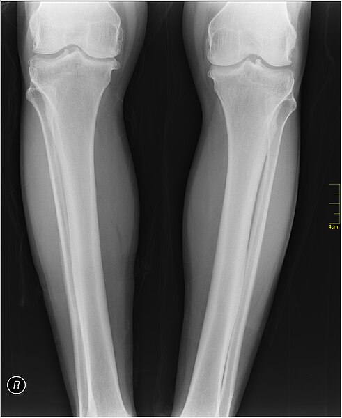 File:Medical X-Ray imaging TTM07 nevit.jpg