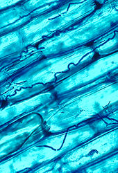 A microscopic view of blue-stained cells, some with dark wavy lines in them