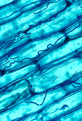 Mycelium of Neotyphodium coenophialum between leaf cells of the reed fescue