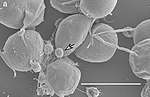 Thumbnail for Melainabacteria