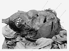 Primer plano de la cabeza de la momia de Seqennenra Taa con las heridas abiertas visibles; fotografía de 1912.