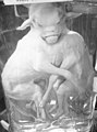 Likene av sammenvokste kalver nedlagt på sprit på en utstilling i Dupuytren anatomiske museum i Paris