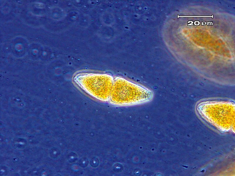 File:Two-celled teliospore of Gymnosporangium globosum.jpg