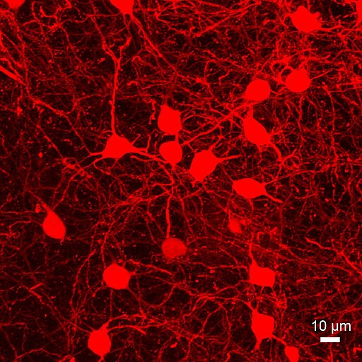 Z MaxProjection of MediumSpinyNeurons Gpr101Cre dtTomato