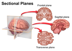 Sectional Planes of the Brain
