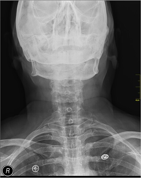 File:Medical X-Ray imaging GUZ04 nevit.jpg