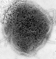 Mumps-Virus, negative-stained TEM.