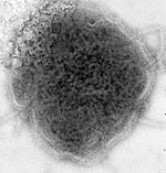 Вірус епідемічного паротиту (електронна мікроскопія).