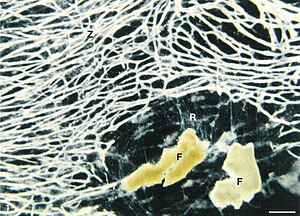 Mørkt feltbillede af cellelegemet (Z) af Reticulomyxa filosa.  Nederst til højre er der fødepartikler (hvedekim, (F)) indlejret i et fint netværk af reticulopodia (R).