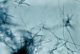 Культура Streptomyces sp. на мікроскопному склі