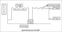 Pressure-time curve for APRV. 'P high' is the high CPAP, 'P low' is the low CPAP, 'T high' is the duration of 'P high,' and 'T low' is the release period or the duration of 'P low.' Spontaneous breathing appears on the top of 'P high.' Airway pressure release ventilation figure 2007.jpg