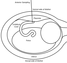 Percutaneous umbilical cord blood sampling - series—Normal anatomy:  MedlinePlus Medical Encyclopedia